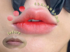 微针植眉作品示例 - 自然效果