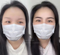 微针植眉作品示例 - 自然效果