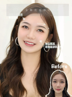 微针植眉作品示例 - 自然效果