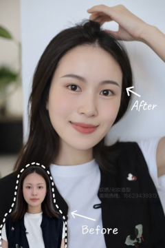 微针植眉作品示例 - 自然效果