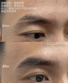 微针植眉作品示例 - 自然效果